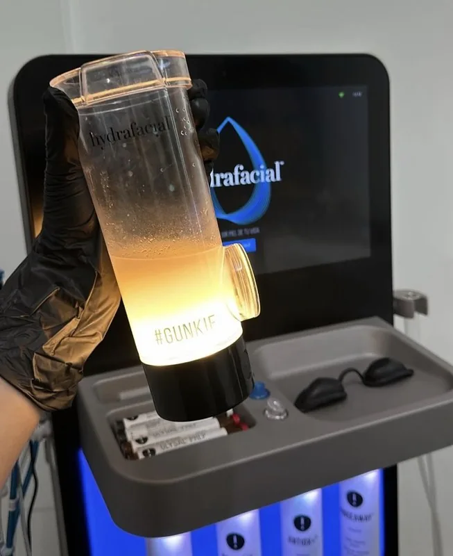 Así limpia el Hydrafacial
